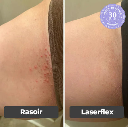 Épilateur Indolore 2 en 1 - Laserflex